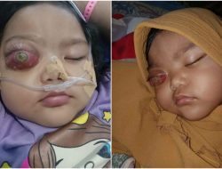 Terkena Kanker Retino Blastoma, Seorang Bocah di Gunung Terang Tulangbawang Barat Butuh Uluran Tangan