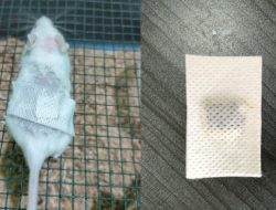 Patch Hydrogel, Inovasi Tim PKM-RE Pined Patch Bantu Atasi Gangguan Ulkus Diabetikum pada Kaki